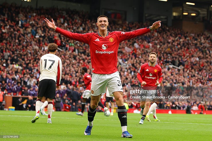 MU trả giá đắt cho chiến thắng Liverpool, Sesko chấn thương ra sao? - 1