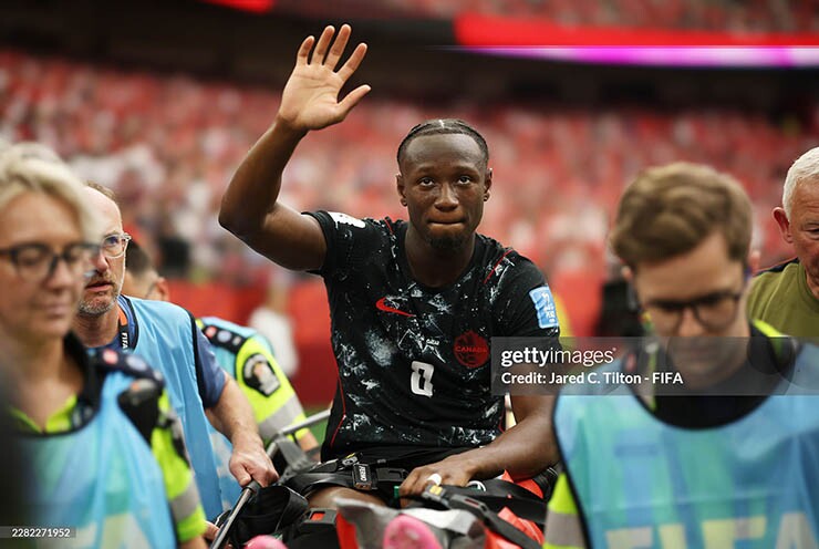 Sao Canada gãy chân nghiêm trọng, đau đớn chia tay World Cup 2026 - 7
