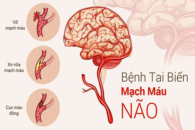 Thiên Ma – Thảo dược “trời ban” hỗ trợ phòng ngừa các bệnh tai biến, huyết áp - 1