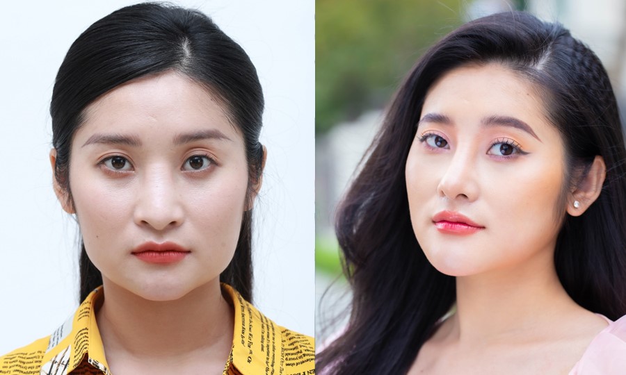 Bệnh viện thẩm mỹ Kangnam tung ưu đãi thẩm mỹ siêu khủng cận Tết  - 4