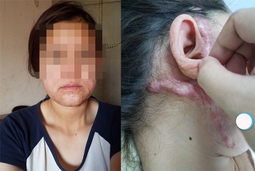 Sinclair Clinic - tiên phong căng da nội soi SMAS an toàn, uy tín, chuyên nghiệp - 4