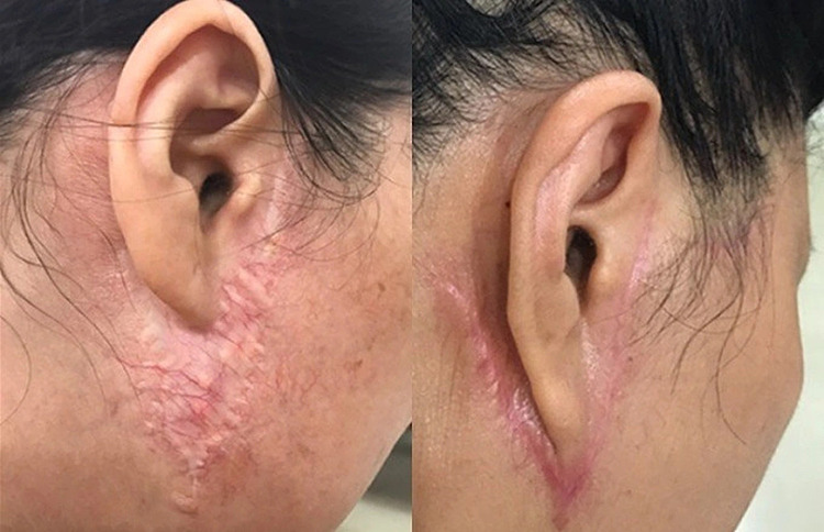 Sinclair Clinic - tiên phong căng da nội soi SMAS an toàn, uy tín, chuyên nghiệp - 5