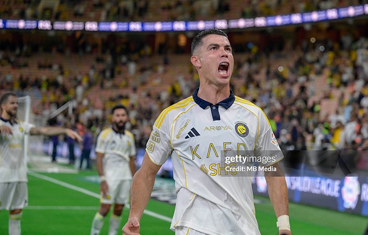 Tỷ phú bóng đá Ronaldo và nỗi ám ảnh sợ bị...hói đầu - 1