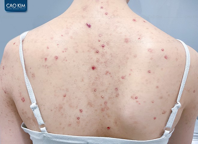 Phòng khám Cao Kim - Địa chỉ chữa viêm nang lông uy tín được đông đảo khách hàng bình chọn - 2