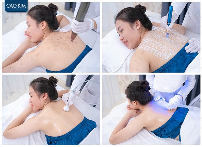 Phòng khám Cao Kim - Địa chỉ chữa viêm nang lông uy tín được đông đảo khách hàng bình chọn - 4