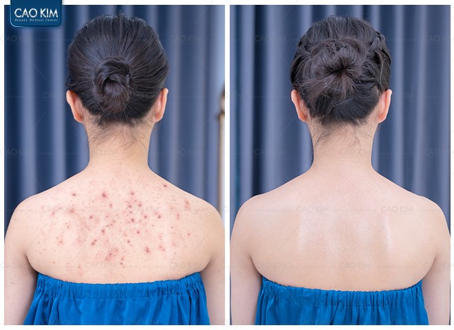 Phòng khám Cao Kim - Địa chỉ chữa viêm nang lông uy tín được đông đảo khách hàng bình chọn - 5