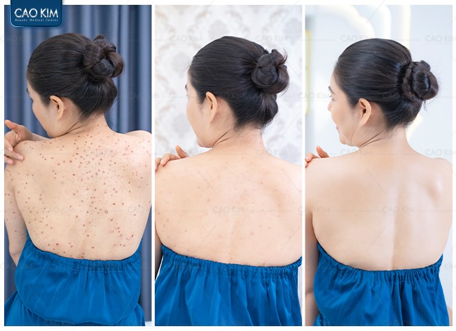 Phòng khám Cao Kim - Địa chỉ chữa viêm nang lông uy tín được đông đảo khách hàng bình chọn - 6