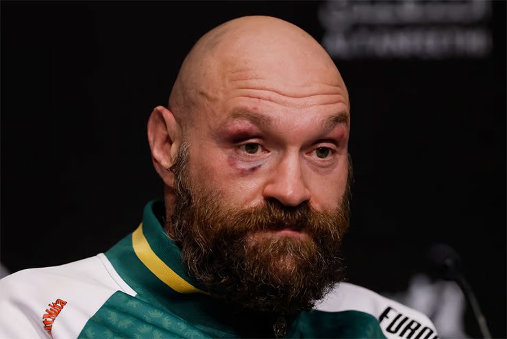 "Vua giang hồ" Tyson Fury bất ngờ giải nghệ, làng boxing bán tín bán nghi - 1