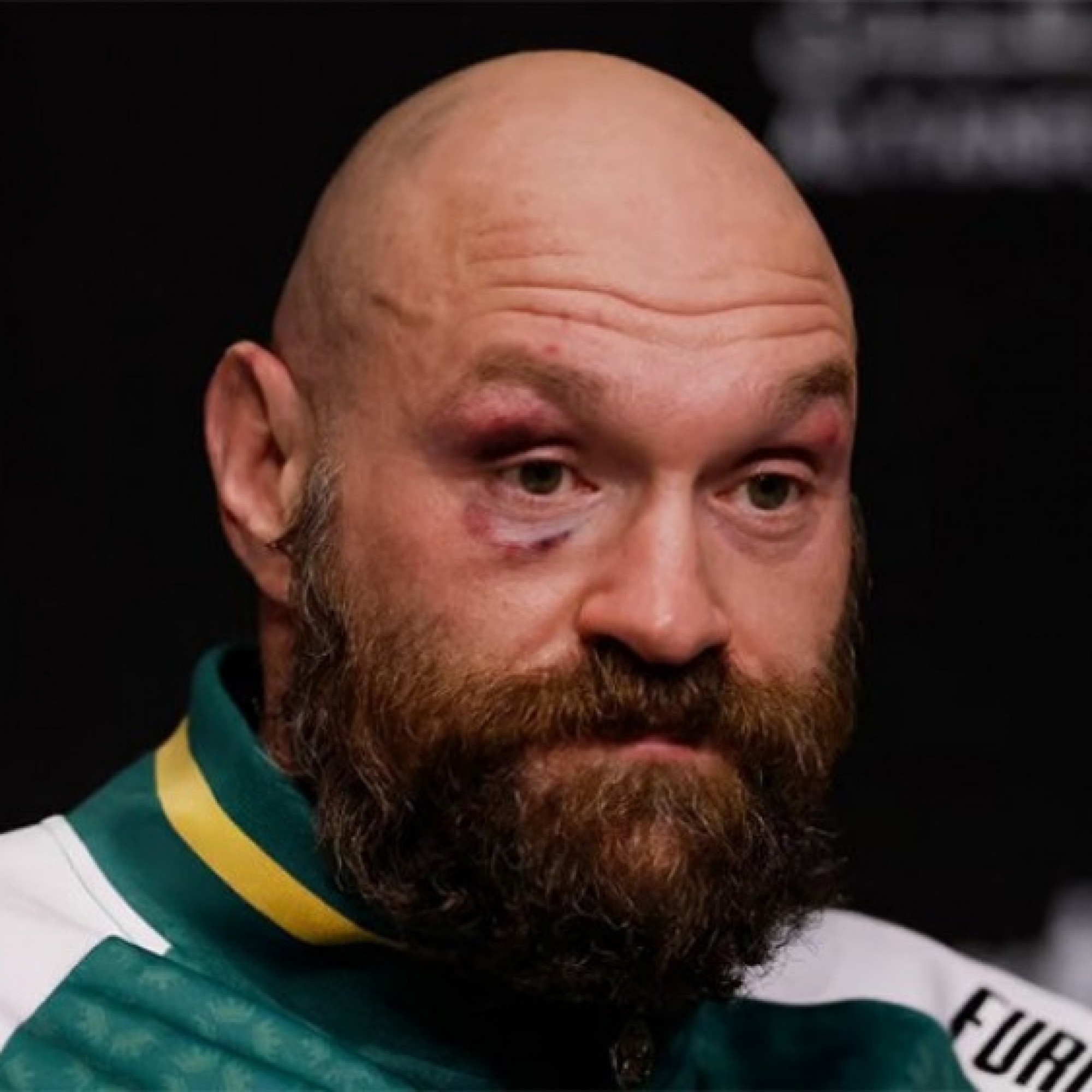  - "Vua giang hồ" Tyson Fury bất ngờ giải nghệ, làng boxing bán tín bán nghi