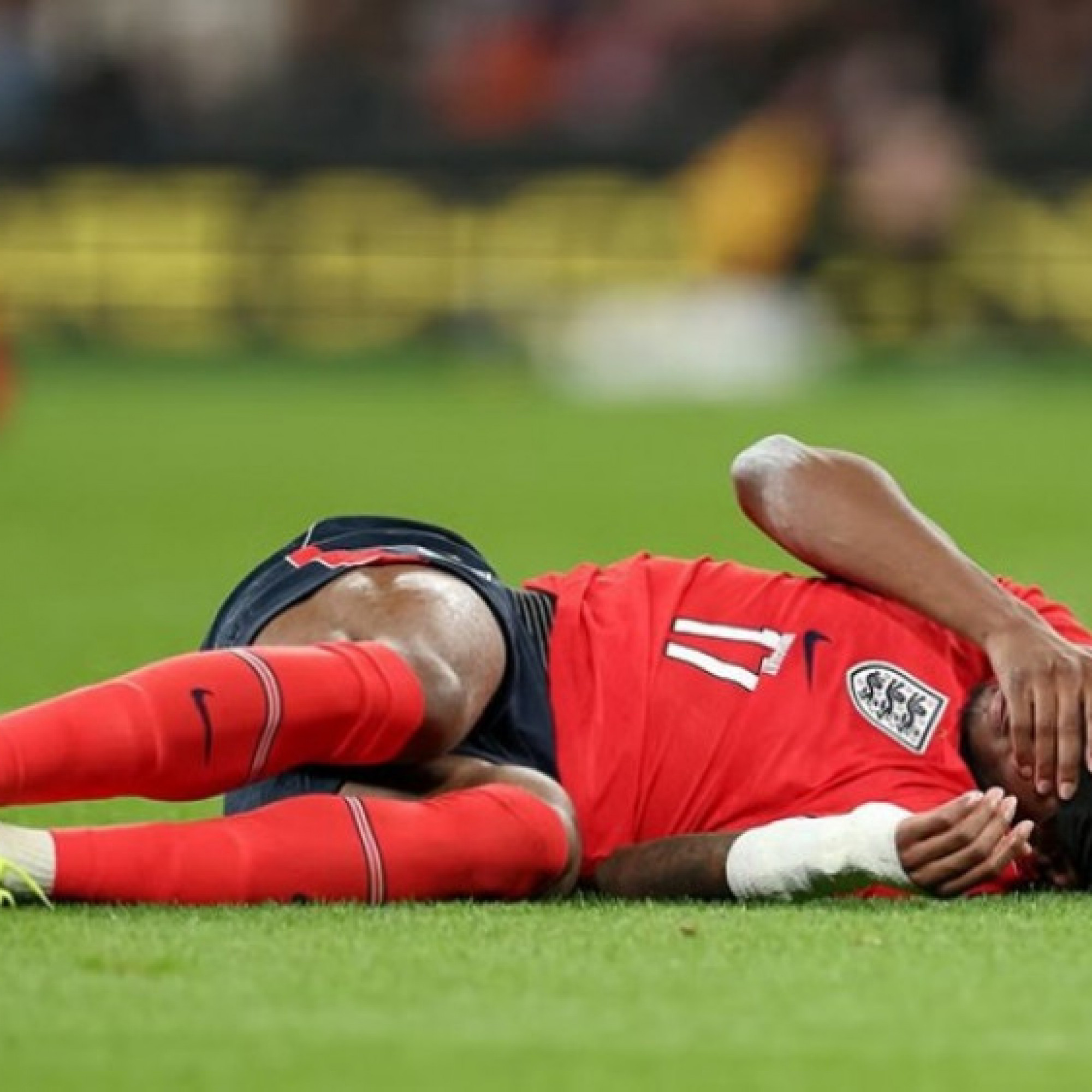  - Arsenal nhận tin dữ: Madueke chấn thương phải chống nạng, Arteta nín thở