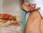 Vạch mặt thủ phạm gây mẩn ngứa khi ngủ trên tàu xe,  khách sạn.