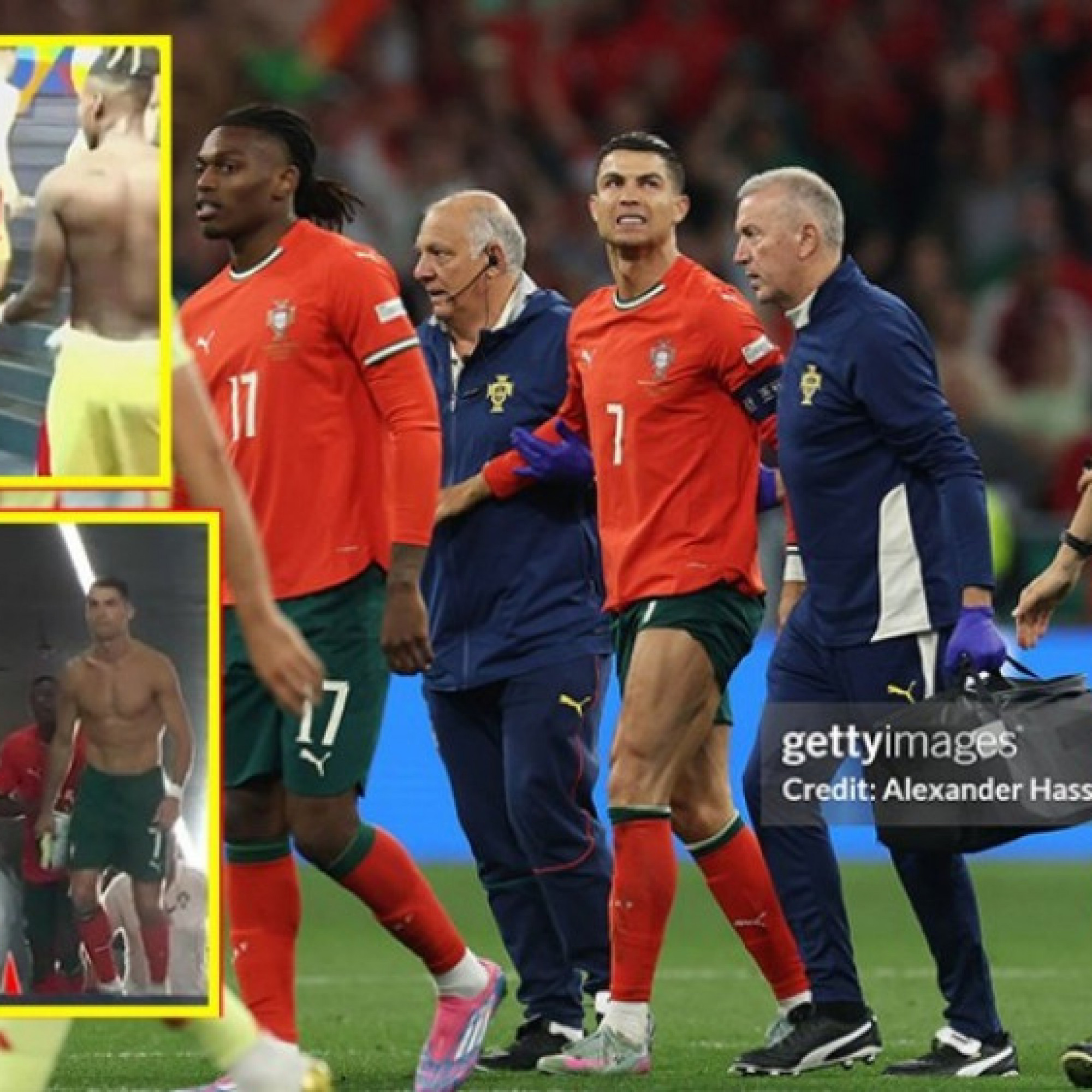  - Ronaldo rời sân vì chấn thương, đổi áo với sao Tây Ban Nha sau hiệp 1