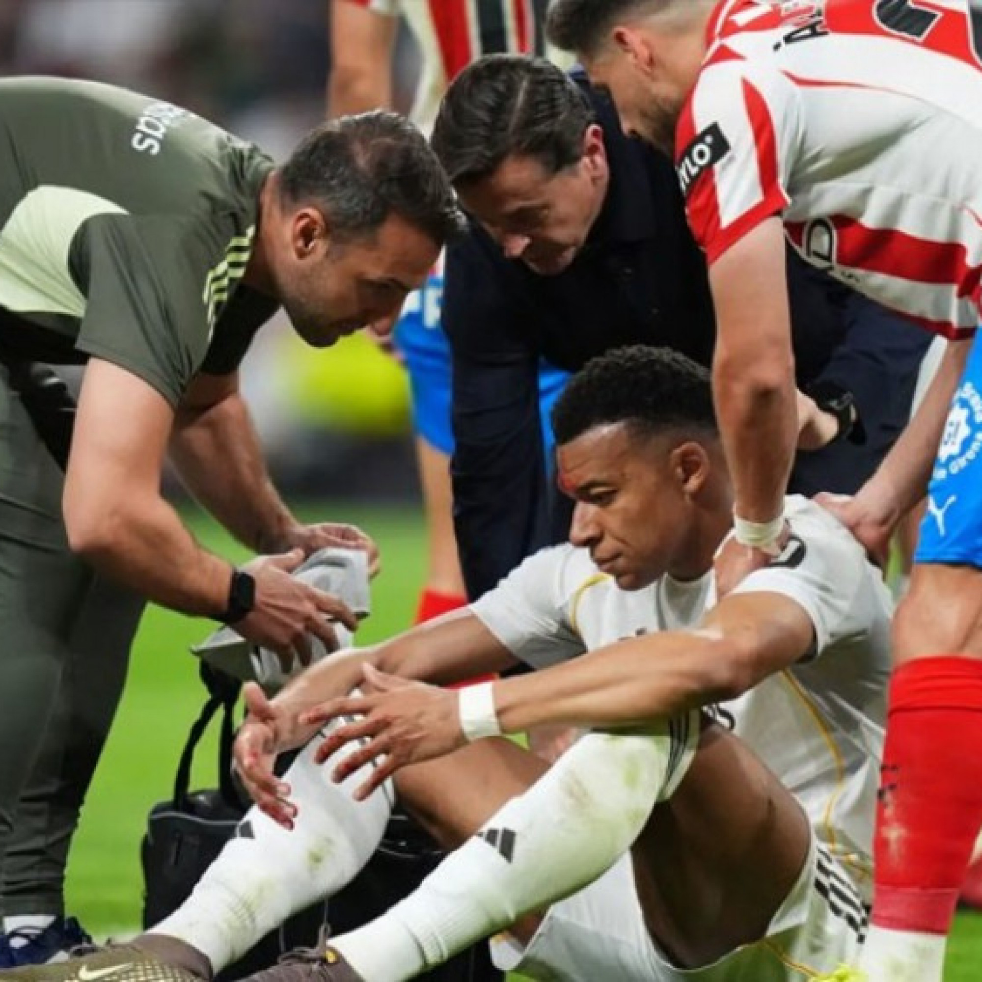  - Mbappe chảy máu vì dính cùi chỏ, Real Madrid điên tiết vì mất phạt đền