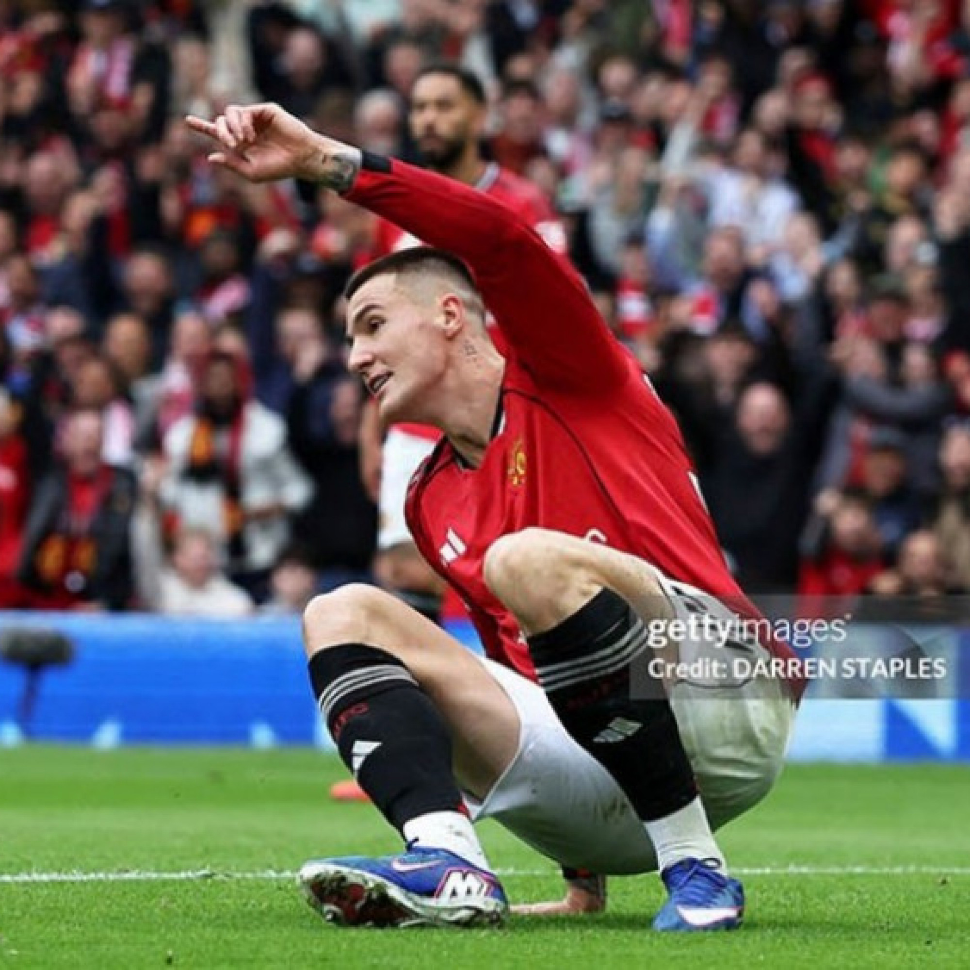  - MU trả giá đắt cho chiến thắng Liverpool, Sesko chấn thương ra sao?
