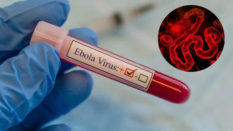 Bộ Y tế hỏa tốc yêu cầu phòng chống bệnh do virus Ebola, tỉ lệ tử vong có thể lên tới 90% - 1