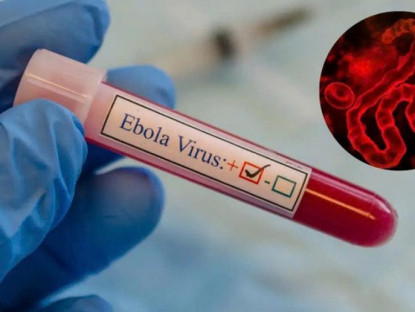 Chuyển động - Bộ Y tế hỏa tốc yêu cầu phòng chống bệnh do virus Ebola, tỉ lệ tử vong có thể lên tới 90%