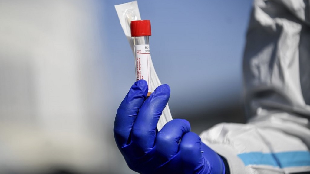 Xét nghiệm PCR cho du khách lên tới 6.000 USD ở một số nước - 2