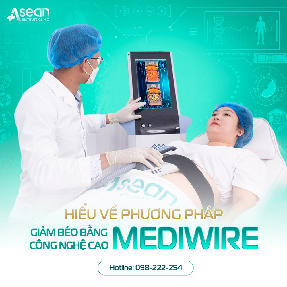 Dịch vụ giảm béo Mediwire tại Thẩm mỹ Quốc tế Asean có gì đặc biệt? - 1