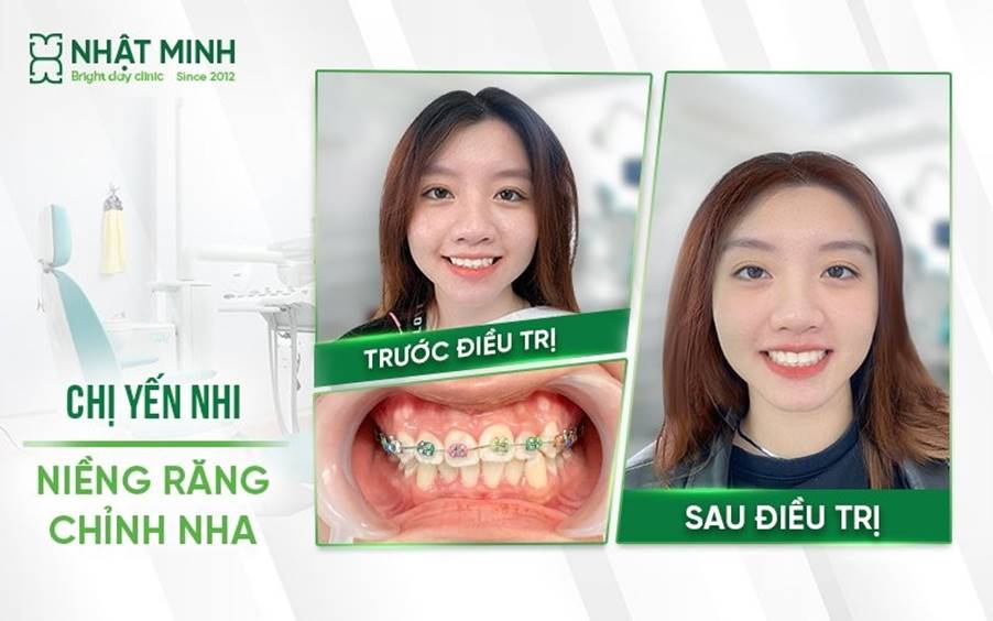 Nha khoa Nhật Minh - Hệ thống nha khoa 5 sao được hàng chục nghìn khách hàng tin tưởng - 3