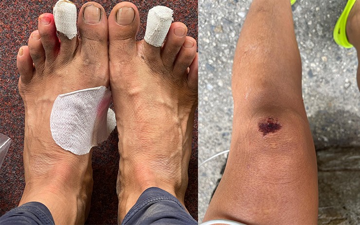 “Dị nhân” Lê Thị Hằng chạy hơn 176km trong 42 giờ, đua cùng cao thủ thế giới - 2