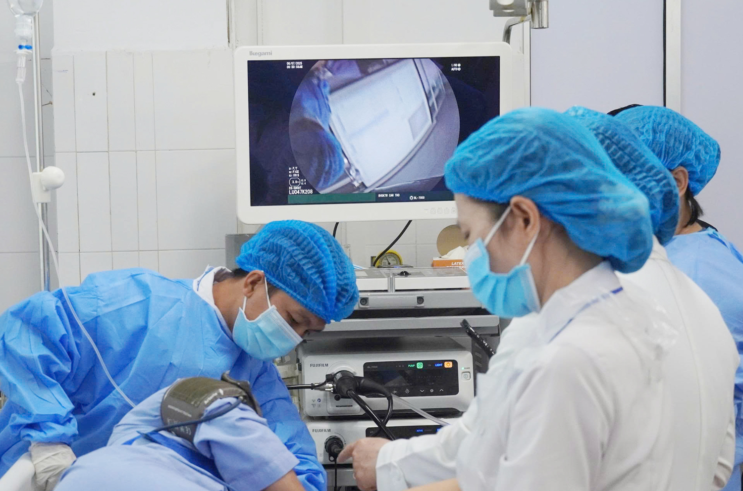 Bệnh viện Đa khoa Trung ương Cần Thơ triển khai hệ thống nội soi siêu âm đầu tiên tại miền Tây - 2