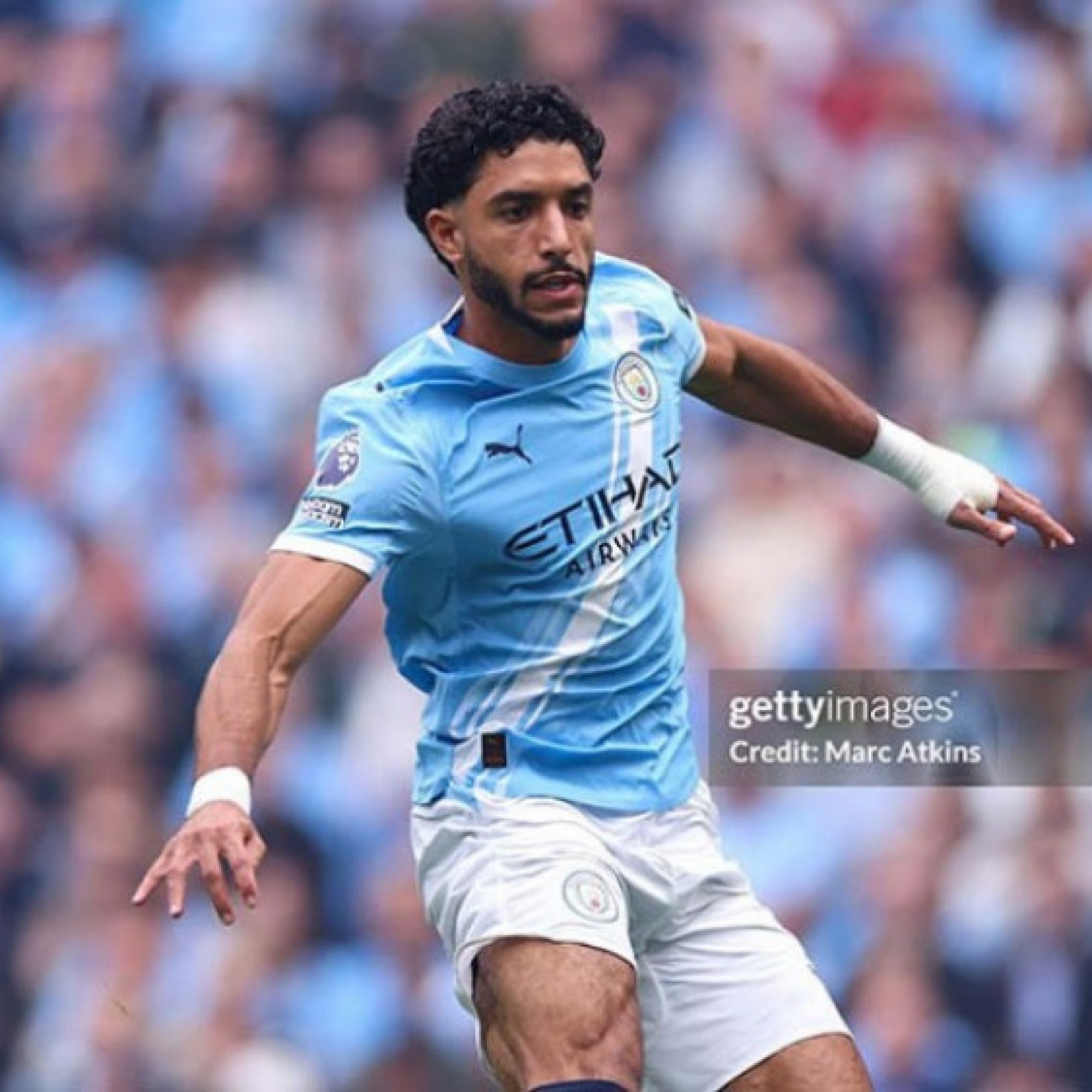 - Sao 80 triệu euro chấn thương nặng, Man City khốn đốn trước derby Manchester
