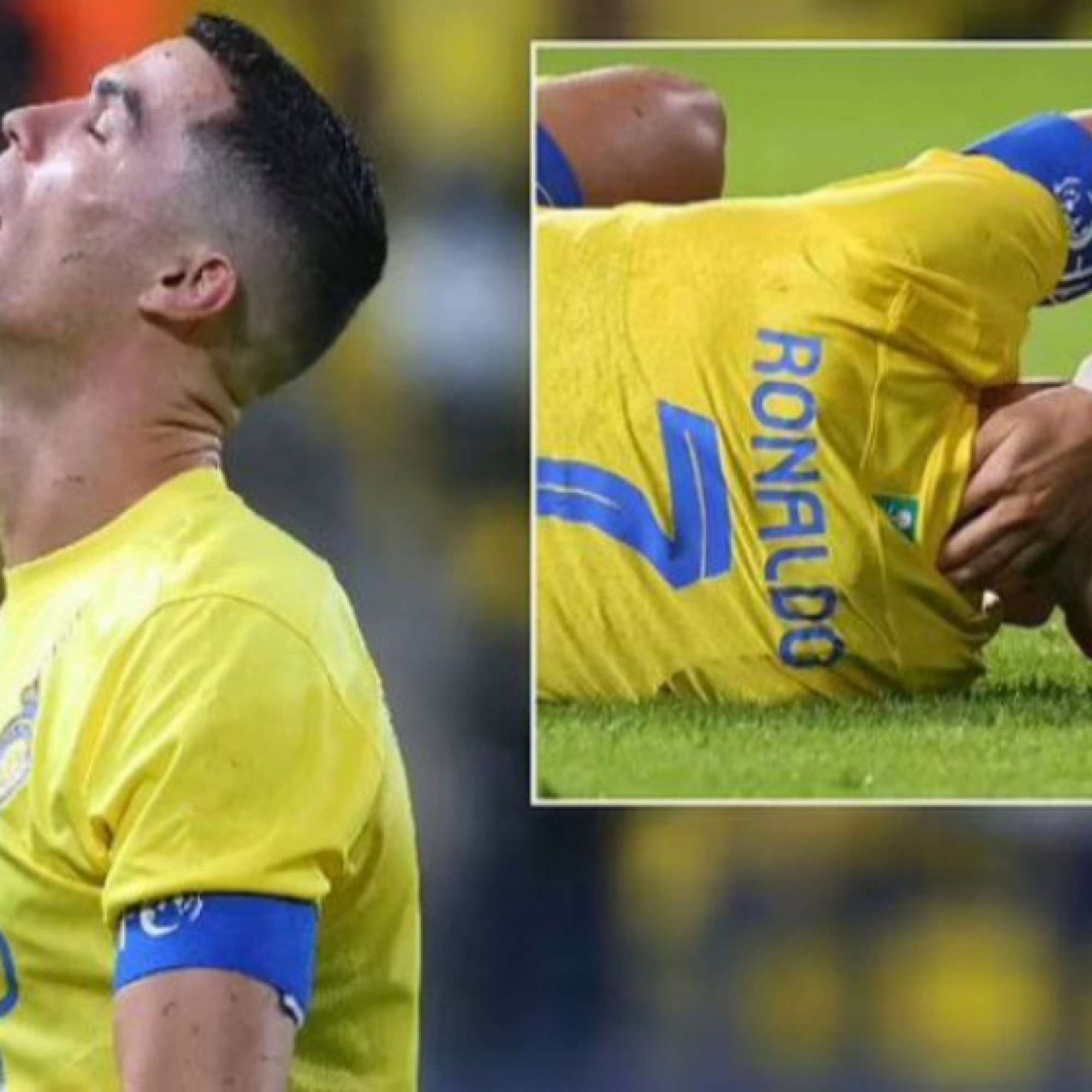  - Ronaldo chấn thương vùng cổ, vắng mặt khi Al Nassr thi đấu ở Cúp C1 châu Á