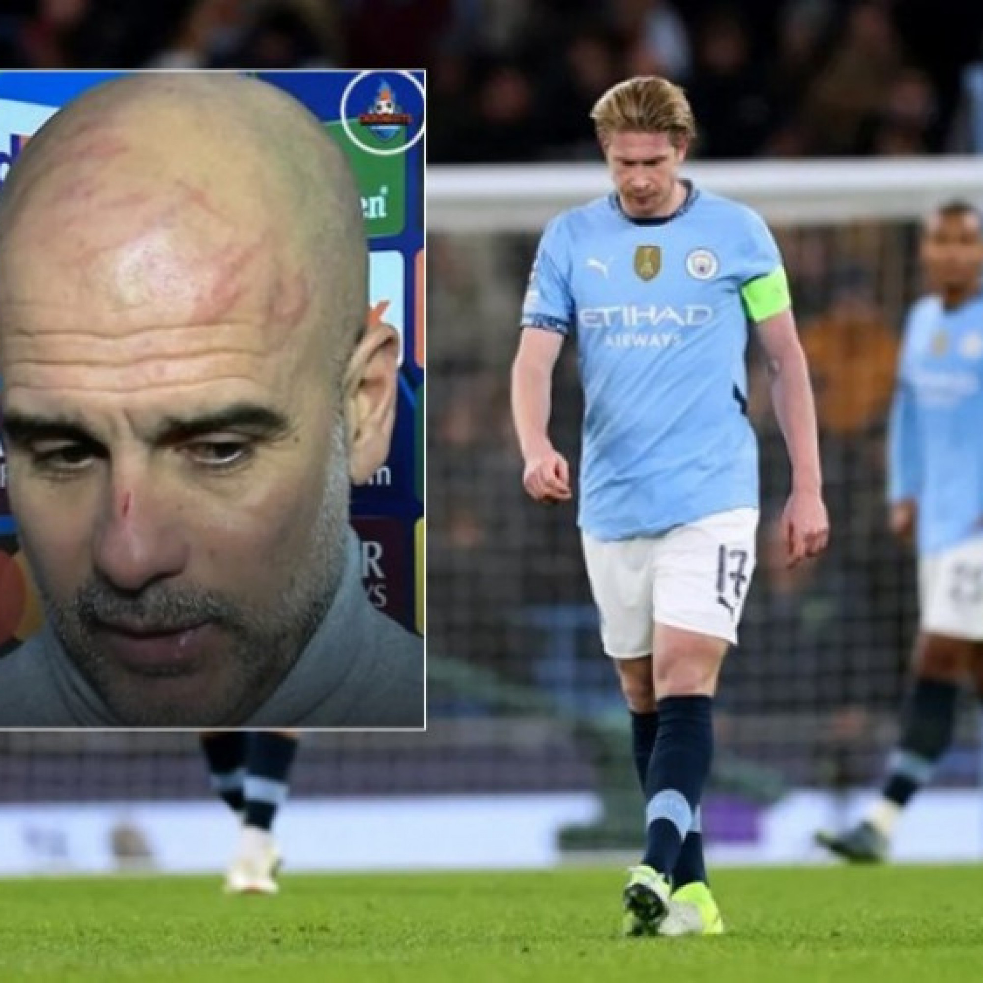  - Man City lập kỷ lục buồn 61 năm, Pep gây sốc với khuôn mặt trầy xước