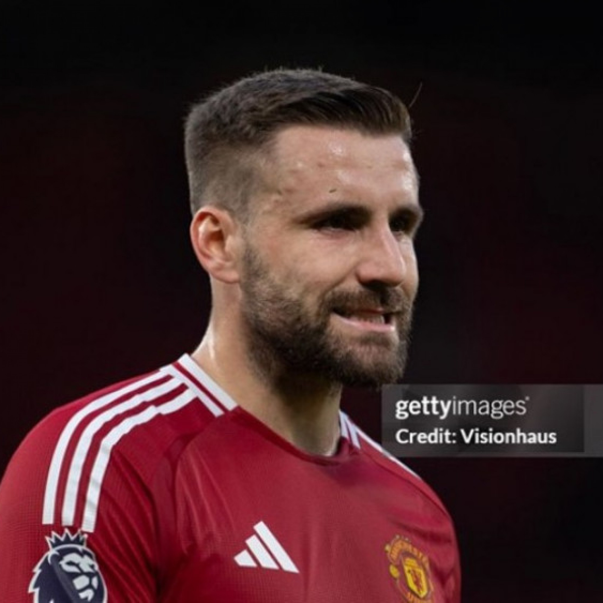  - Shaw lại chấn thương trước trận Arsenal - MU, suy sụp thông báo tin dữ