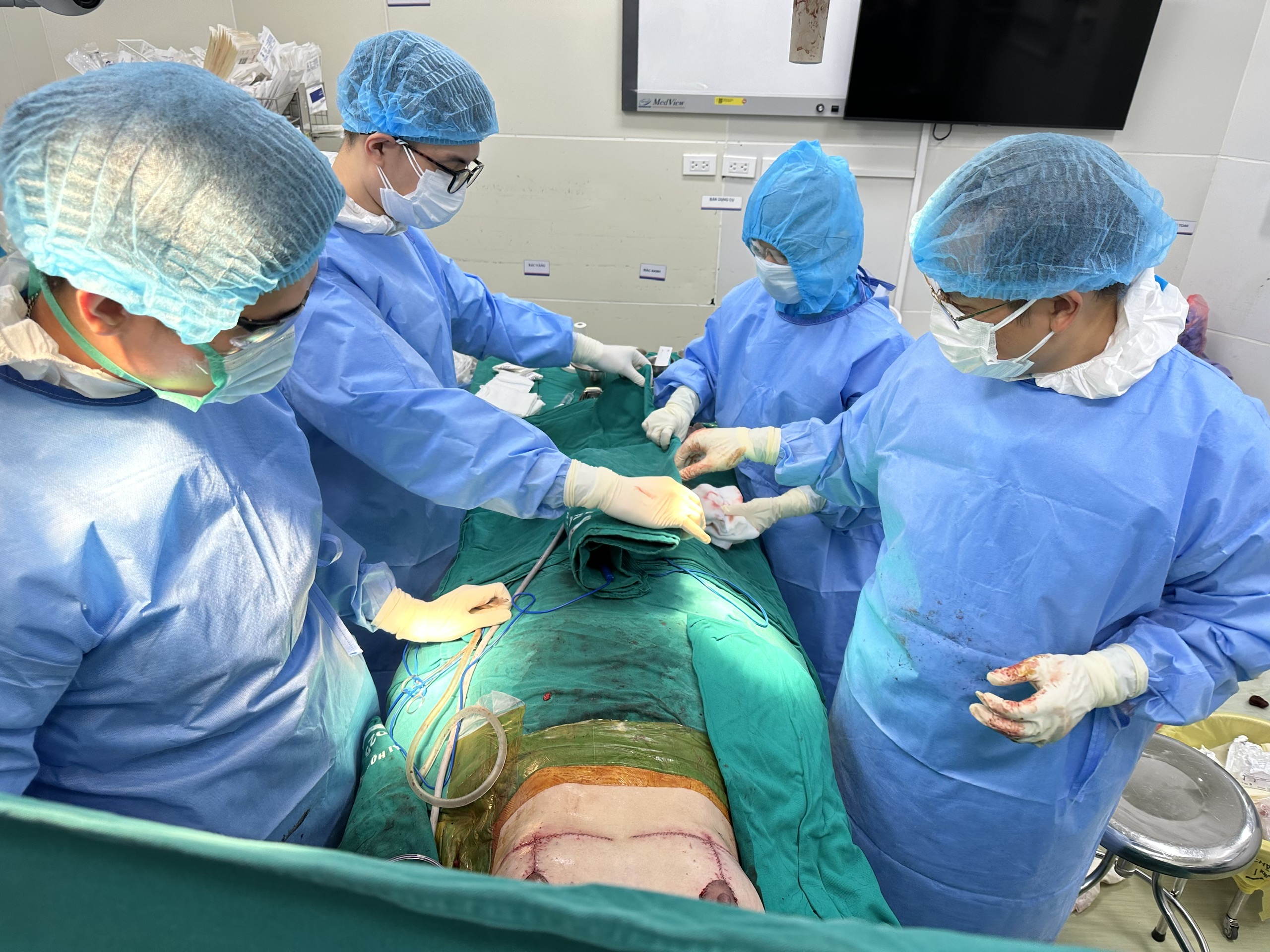 Ca phẫu thuật hơn 7 tiếng cứu bệnh nhân HIV gặp biến chứng khi thẩm mỹ tại cơ sở 'chui' - 2