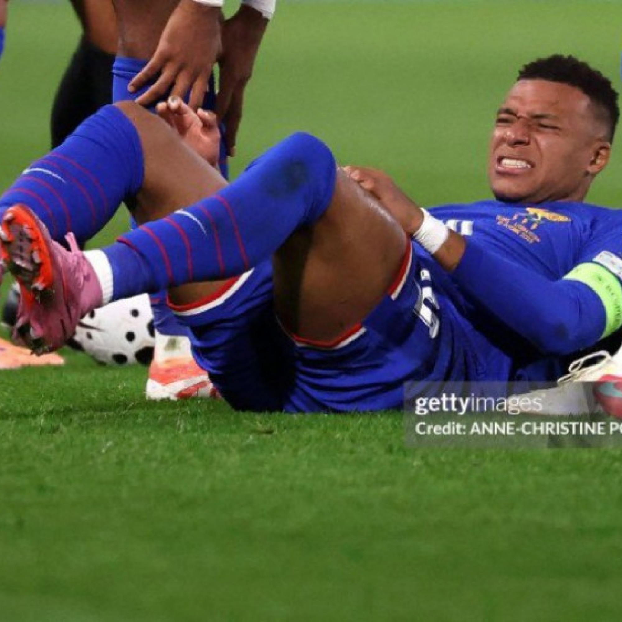  - Mbappe 10 trận ghi bàn không thể ngăn cản, chấn thương nặng ra sao?