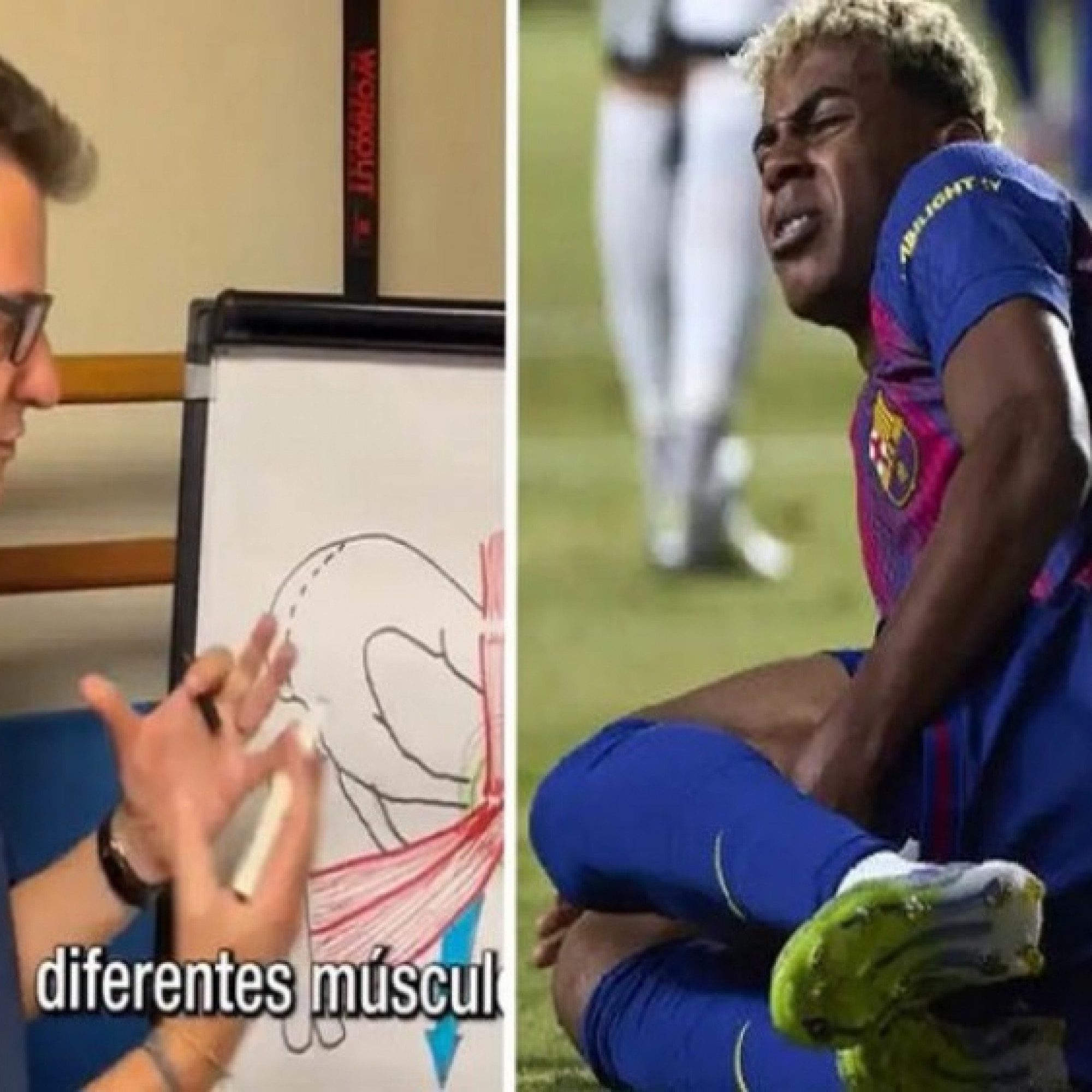  - Yamal dính chấn thương "không thể chữa khỏi", Barca vội vã lo phẫu thuật