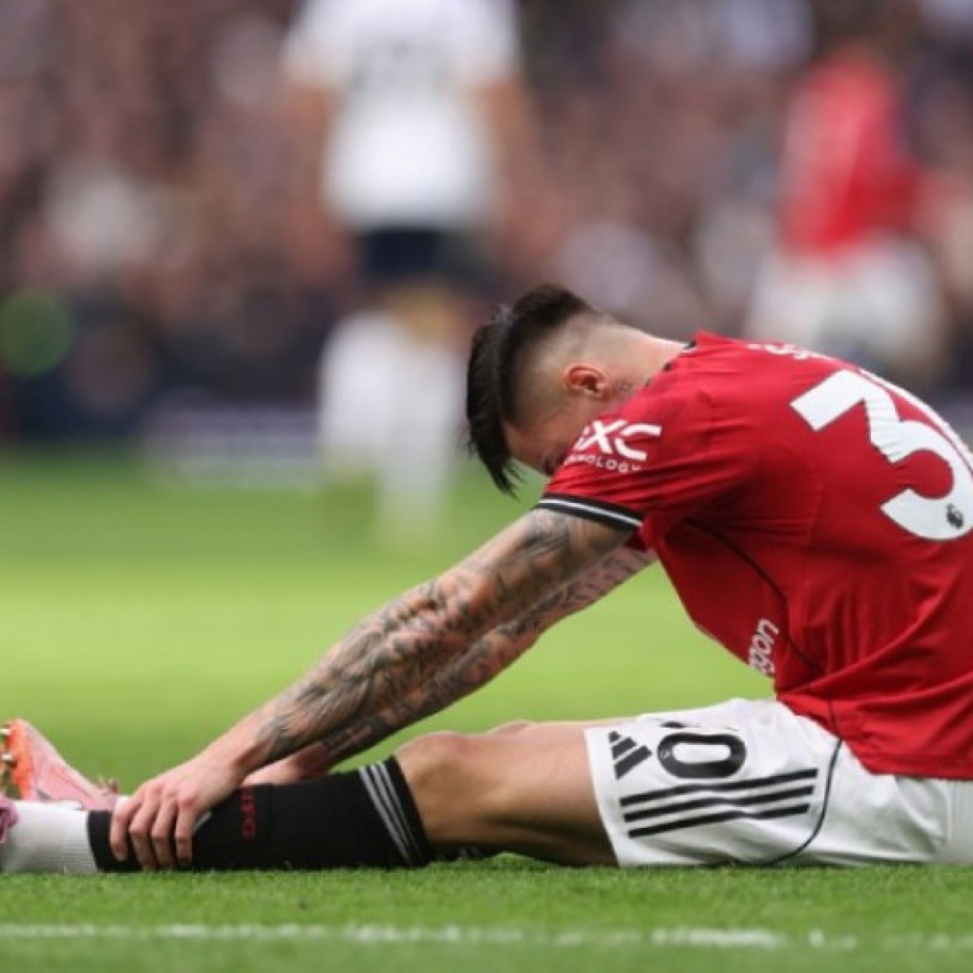  - Sesko nghỉ 1 tháng vì chấn thương, lỡ bao nhiêu trận của MU?