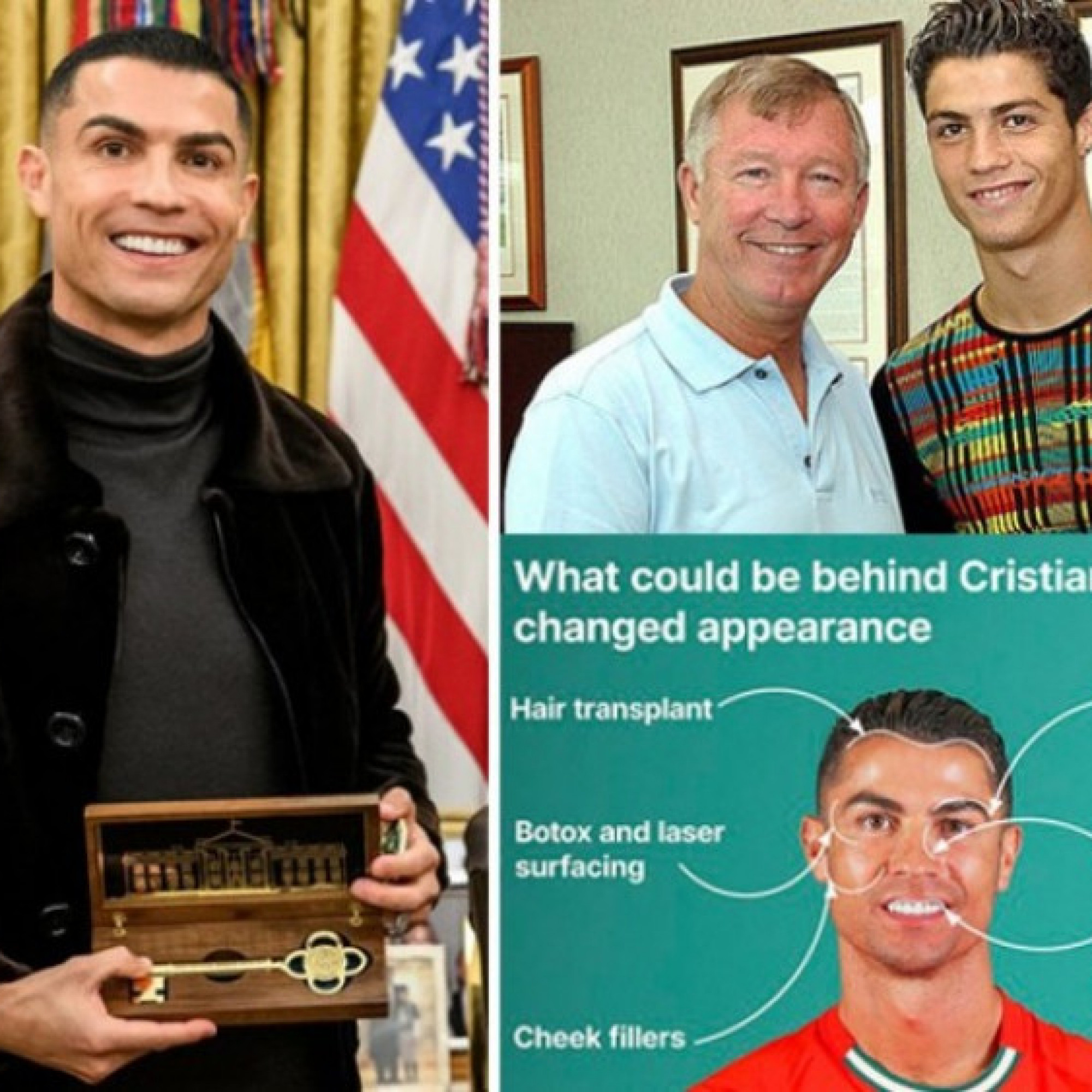  - Bác sĩ thẩm mỹ hé lộ bí mật của Ronaldo, "dao kéo" gần hết khuôn mặt
